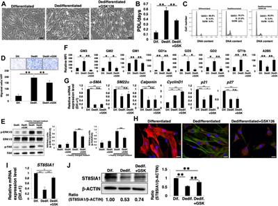 PRC2-dependent regulation of ganglioside expression during dedifferentiation contributes to the proliferation and migration of vascular smooth muscle cells